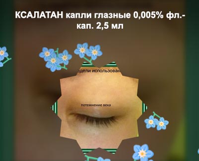 Капли ксалатан для роста ресниц